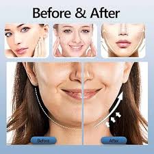 Cinturón de Lifting Facial EMS con LED y Control Remoto